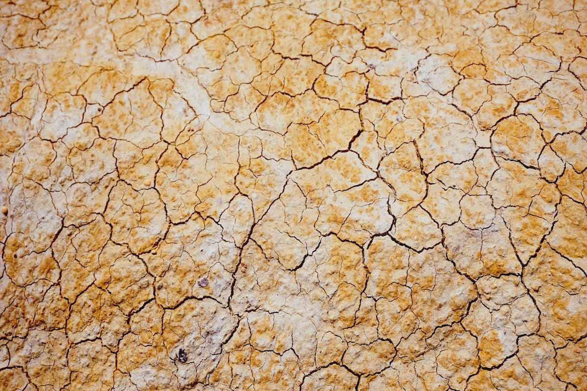 psoriasis