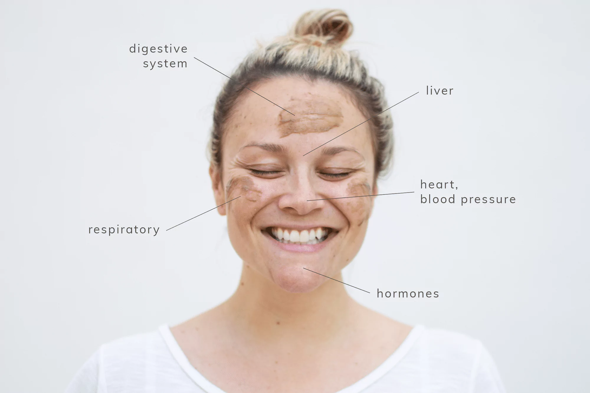 Face Mapping: What Your Pimples Are Trying To Tell You 3