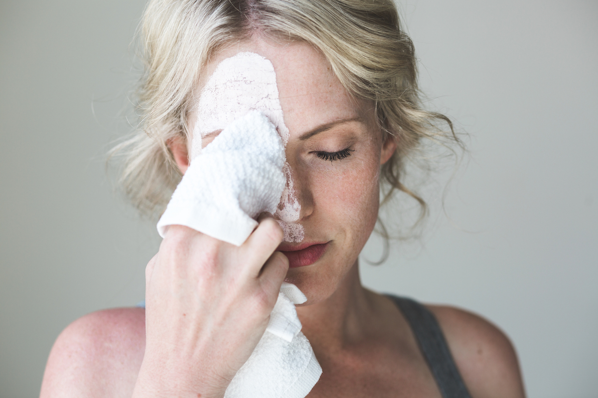 skin purging